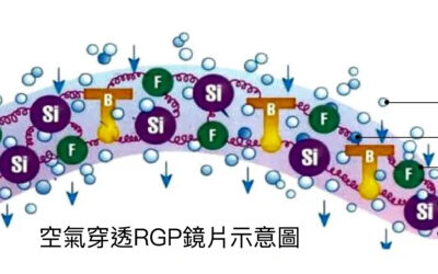 Optact視光學院 | RGP隱形眼鏡材料與DK的關係